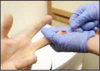 Blood Glucose Reading